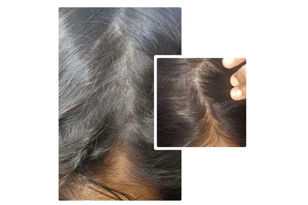Before and After