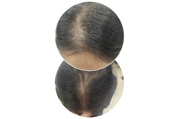 Before and After