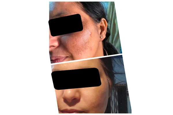 Before and After