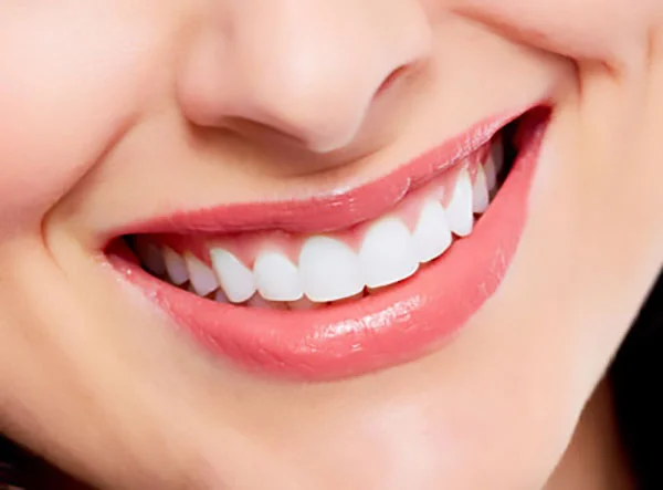 Smile Makeovers