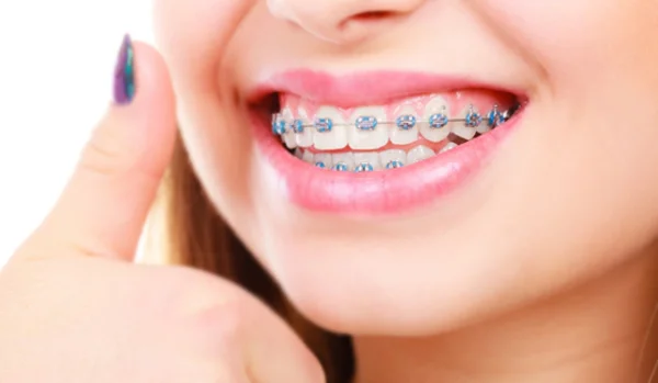 Orthodontics Braces and Aligners