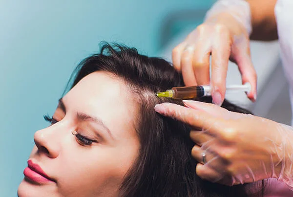 Hair Loss Treatment PRP and Mesotherapy