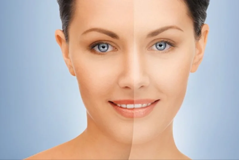 Pigmentation and Skin Brightening